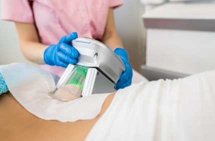 Procedimento de criomodelagem