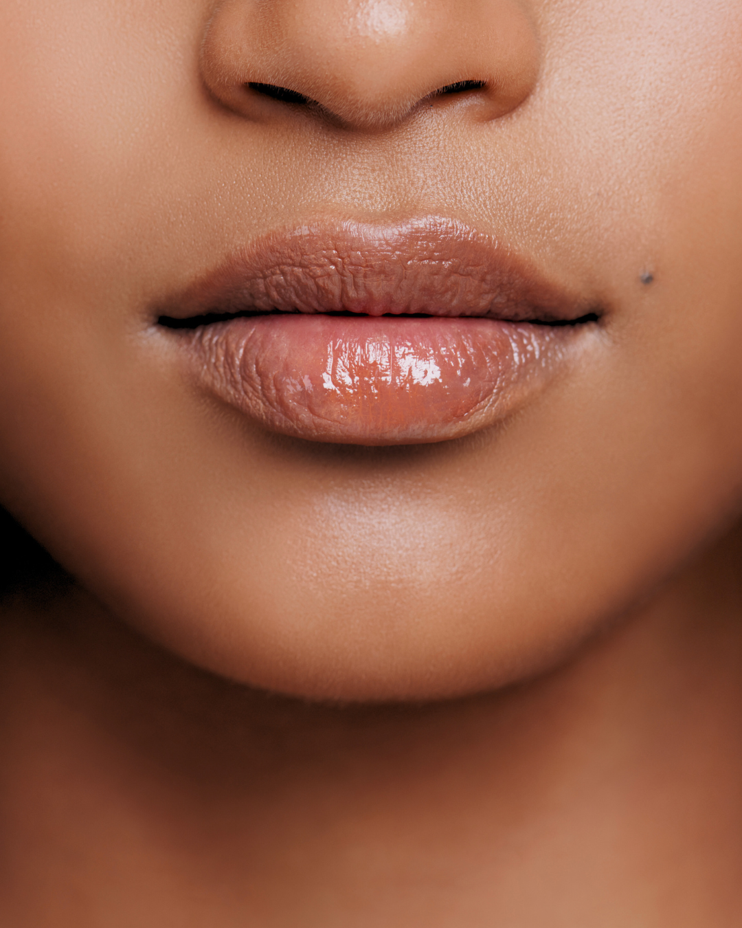 Procedimento de preenchimento labial